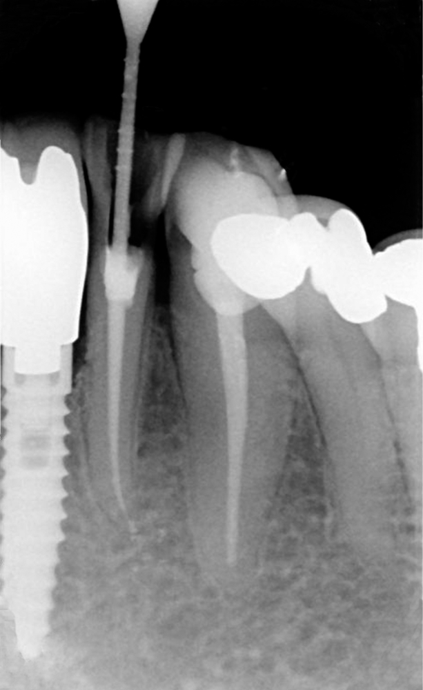 Endodontologie Zahnerhaltung	